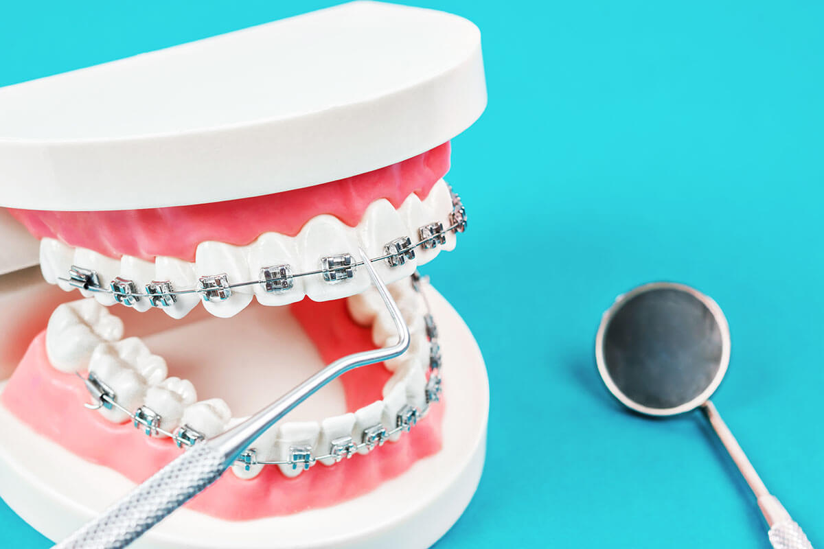 Smile Transformation: Orthodontic Dental Solutions