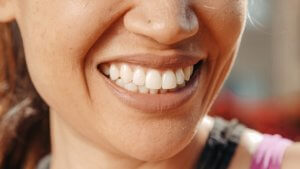 Invisalign Braces For Adults